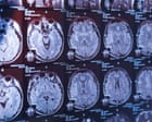 The latest twist in a Canadian medical mystery – podcast